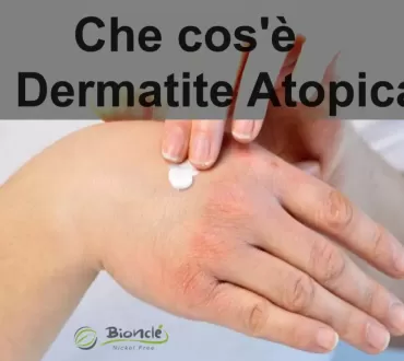 Che cos'è la Dermatite Atopica